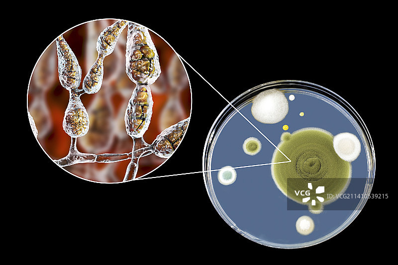 链格孢菌组合图像图片素材