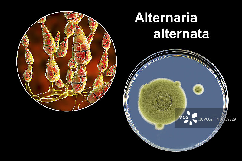链格孢菌组合图像图片素材