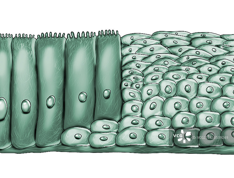 上皮化生，图示图片素材