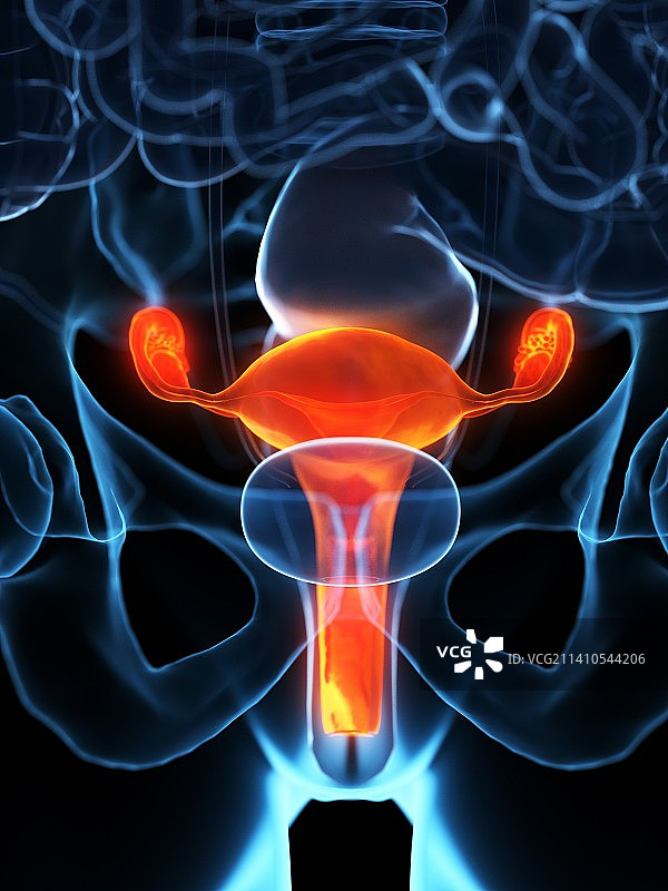 病变子宫插画图片素材