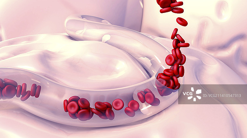 血管出血图示图片素材