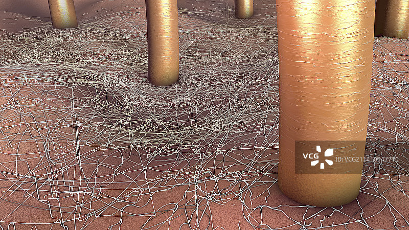 真菌性皮肤感染插图图片素材