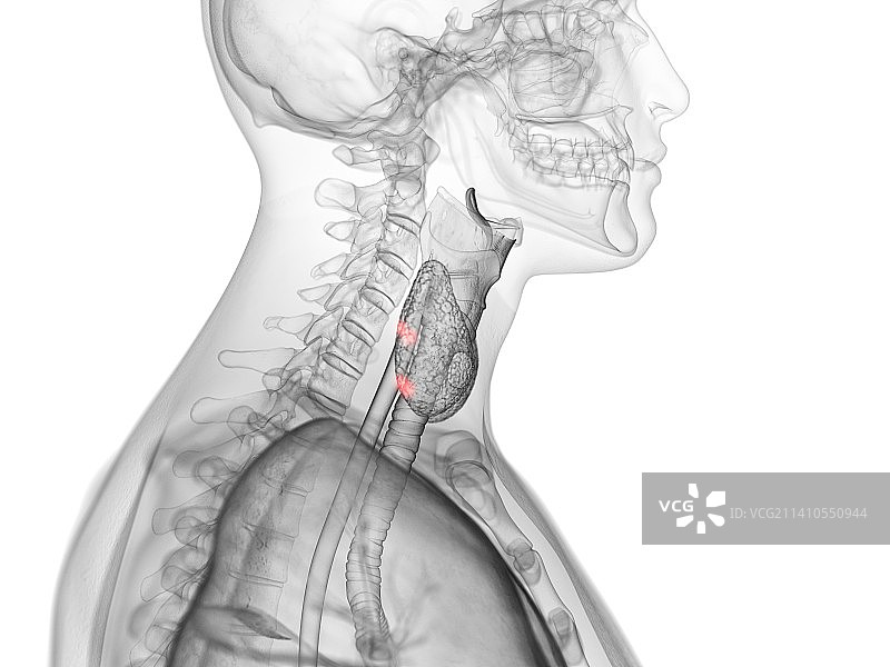 甲状旁腺图示图片素材