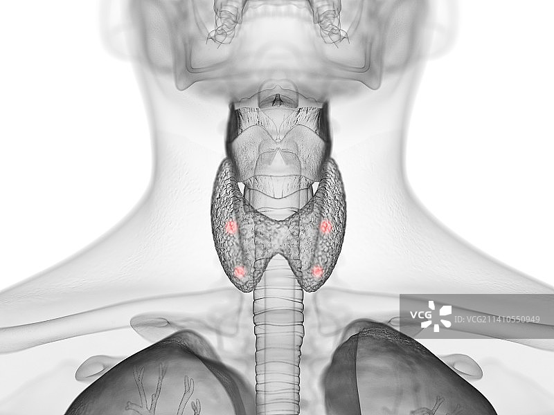 甲状旁腺图示图片素材