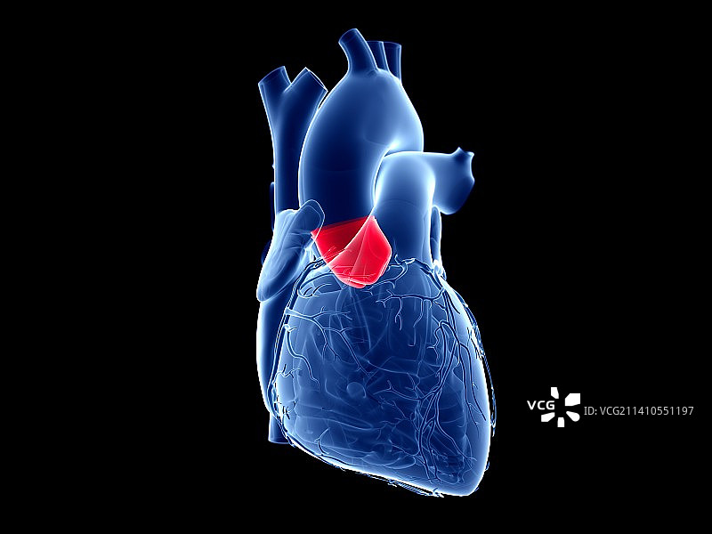 主动脉瓣结构图图片素材
