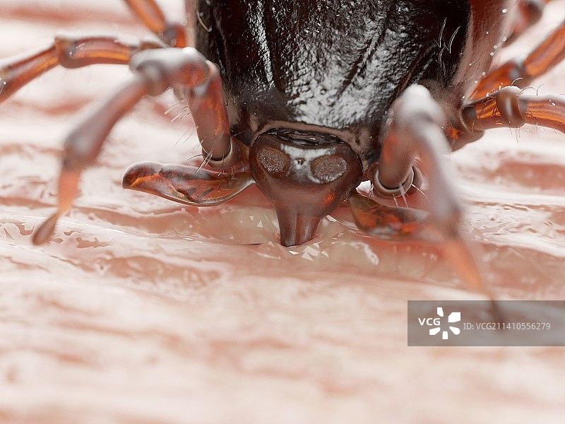 叮咬人体的蜱虫插画图片素材