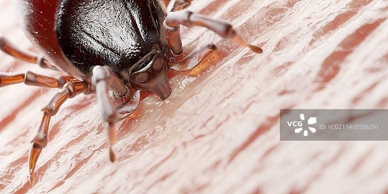 叮咬人体的蜱虫插画图片素材