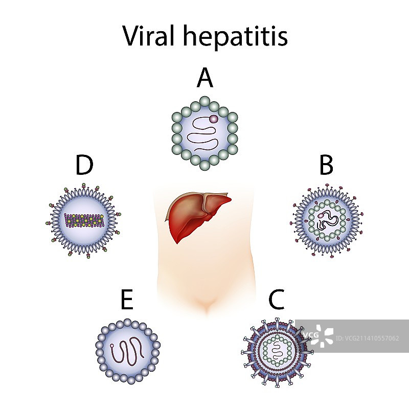 甲乙丙丁戊型肝炎图示图片素材