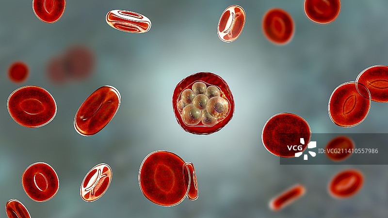 疟疾感染插图图片素材