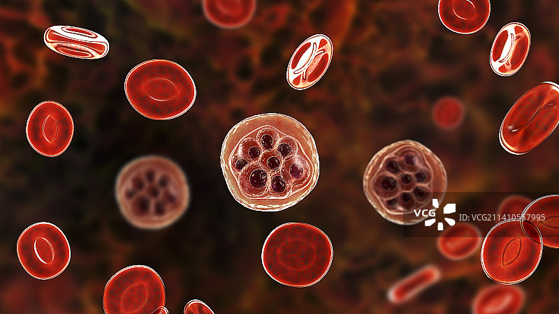 疟疾感染插图图片素材