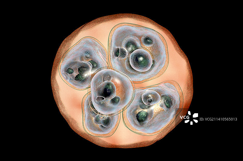 多房棘球绦虫包虫囊肿插图图片素材