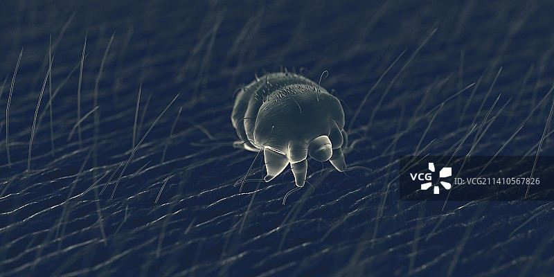 人体皮肤上的疥螨，图解图片素材