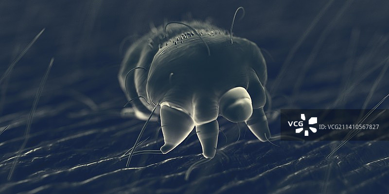 人体皮肤上的疥螨，图解图片素材