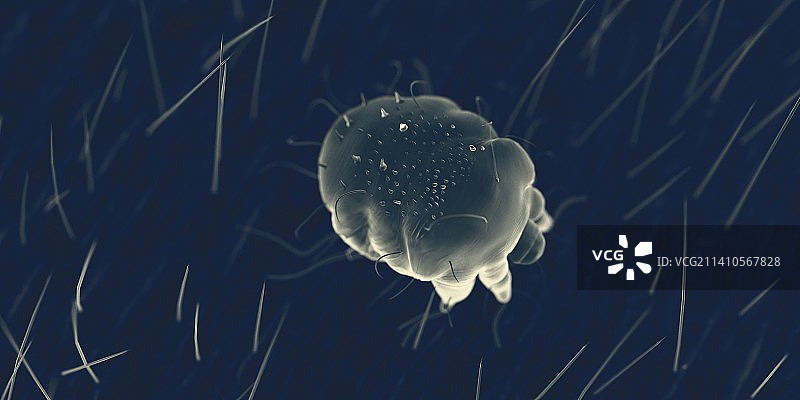 人体皮肤上的疥螨，图解图片素材