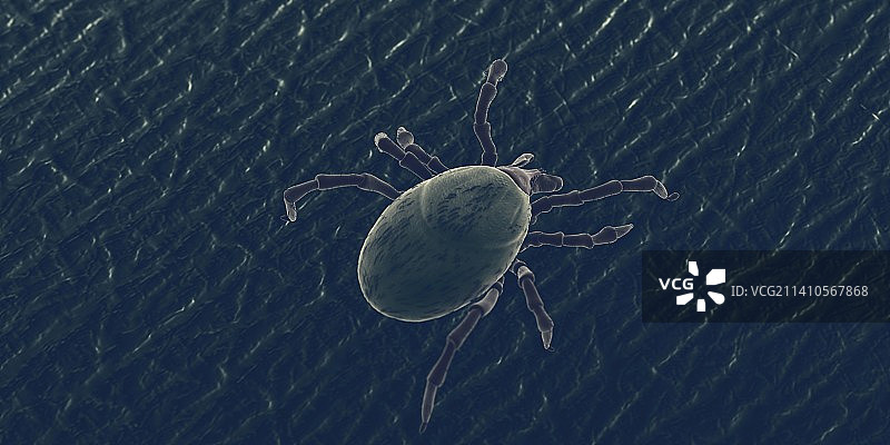 人皮肤上的蜱虫，插图图片素材