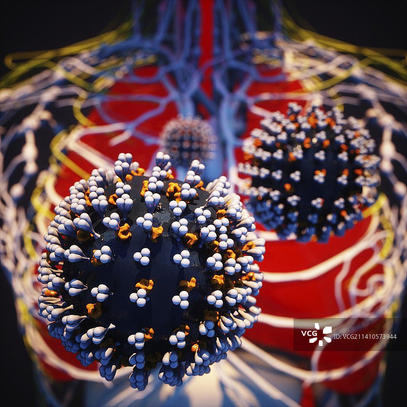 新冠病毒肺部感染插图图片素材