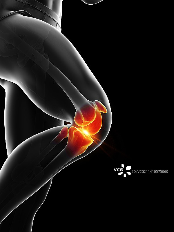 膝盖疼痛插图图片素材