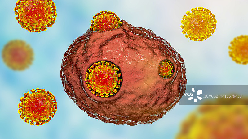 感染人体细胞的新冠病毒图片素材