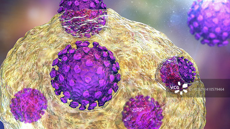 感染人体细胞的新冠病毒图片素材