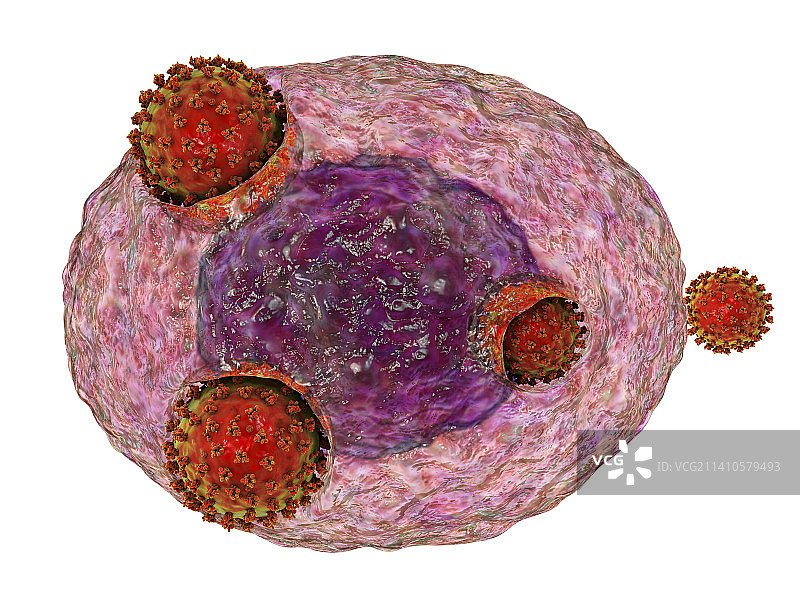 感染人体细胞的新冠病毒图片素材