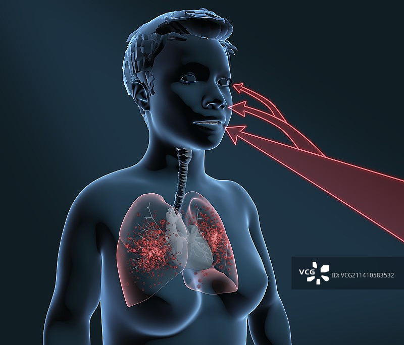 感染途径，3D插画图片素材