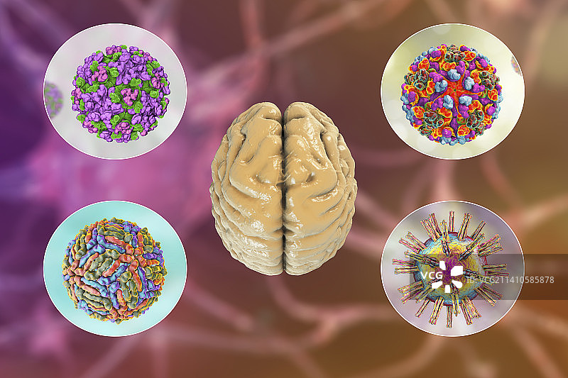 脑部感染插图图片素材