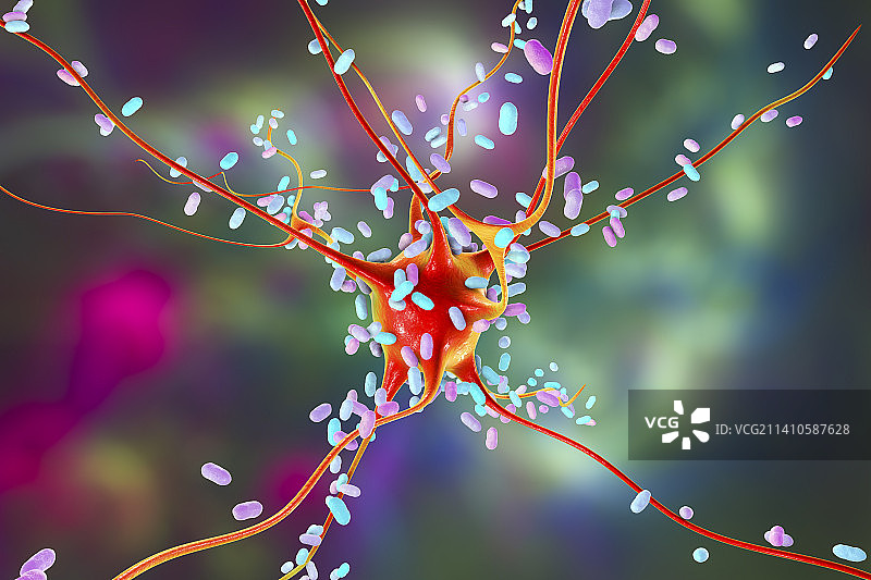 细菌性脑炎插图图片素材
