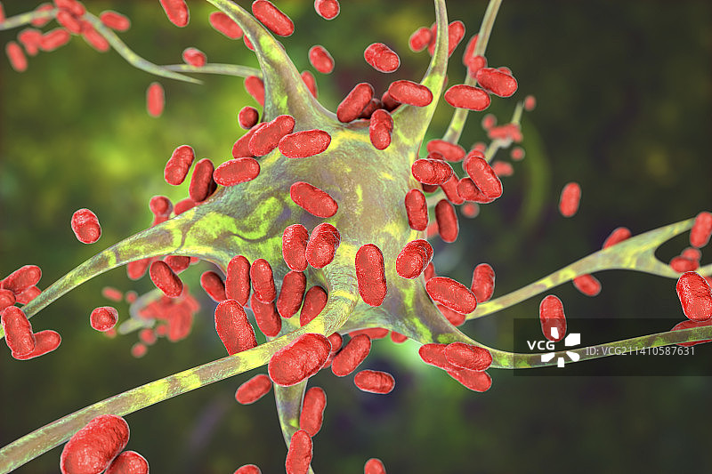 细菌性脑炎插图图片素材