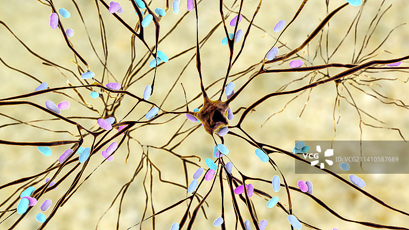 细菌性脑炎插图图片素材