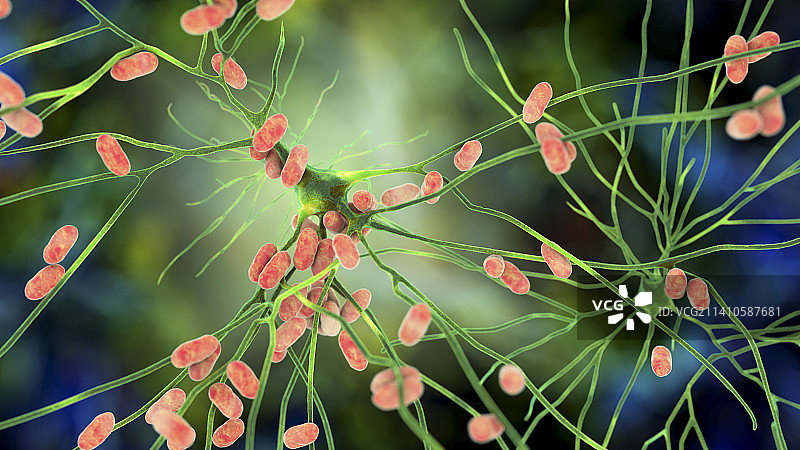 细菌性脑炎插图图片素材