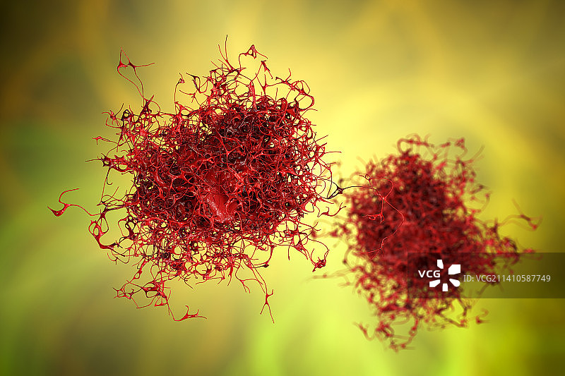 癌细胞，插图图片素材