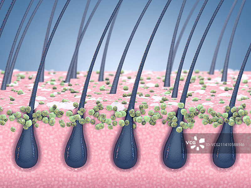真菌感染和头皮屑插画图片素材