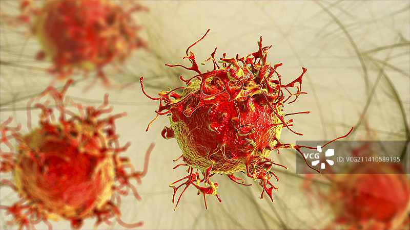 皮肤癌细胞插图图片素材