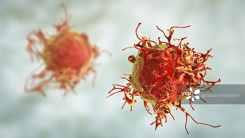 皮肤癌细胞插图图片素材