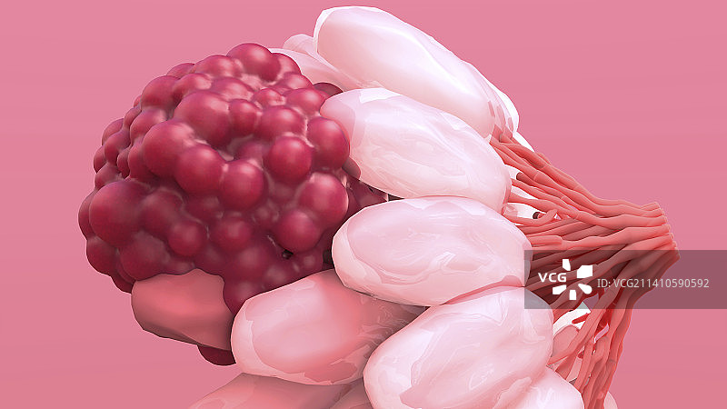 乳腺癌插图图片素材