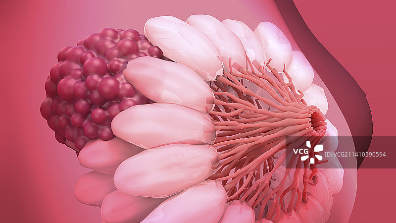 乳腺癌插图图片素材