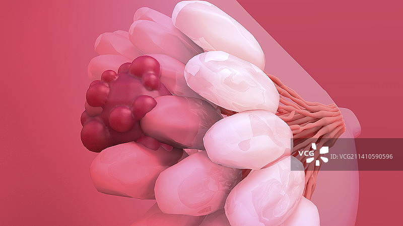 乳腺癌插图图片素材