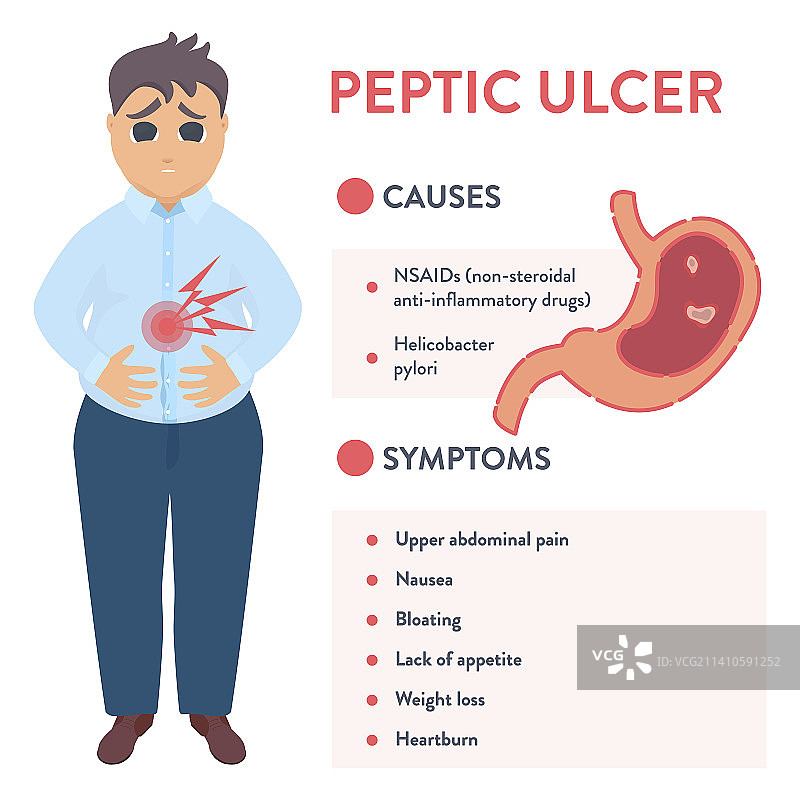 消化性溃疡概念图图片素材