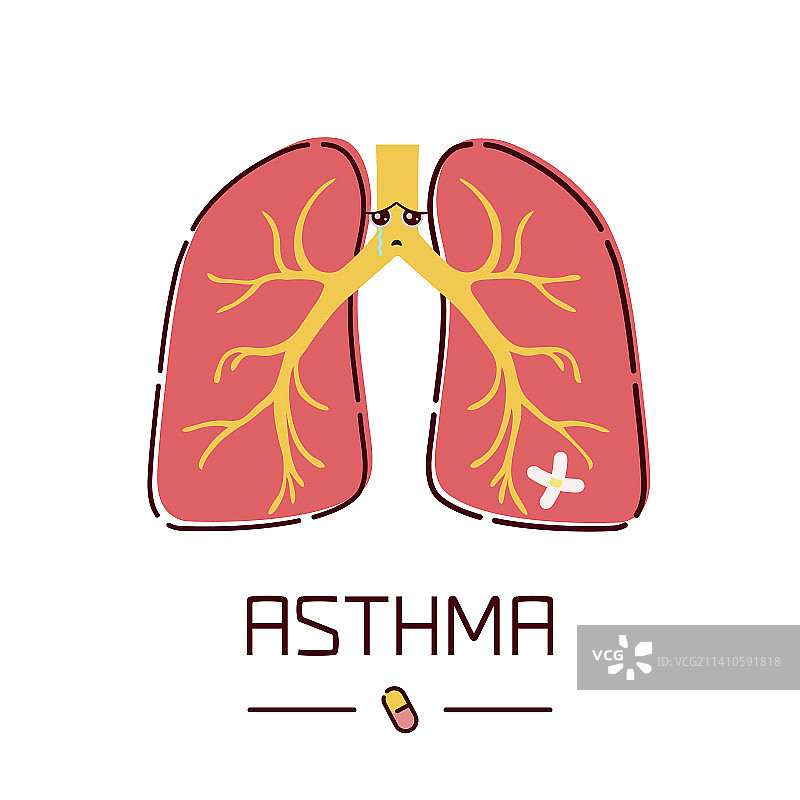 哮喘概念插图图片素材