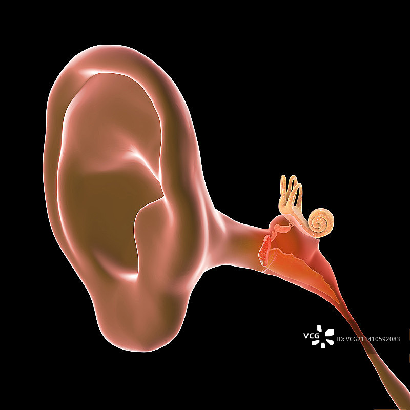 中耳炎耳部感染插图图片素材