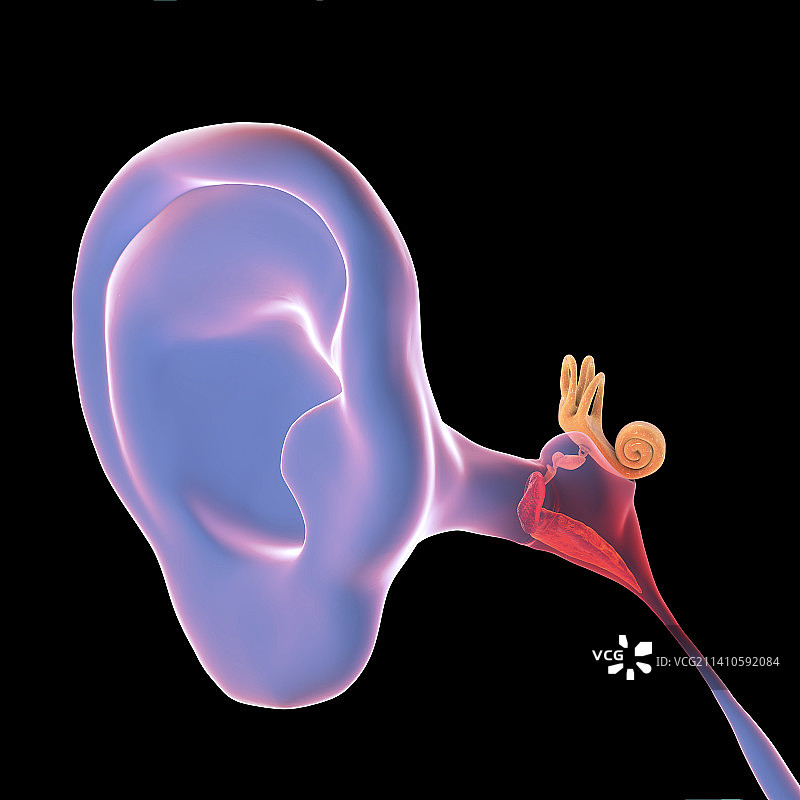 中耳炎耳部感染插图图片素材