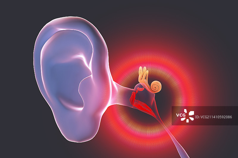 中耳炎耳部感染插图图片素材