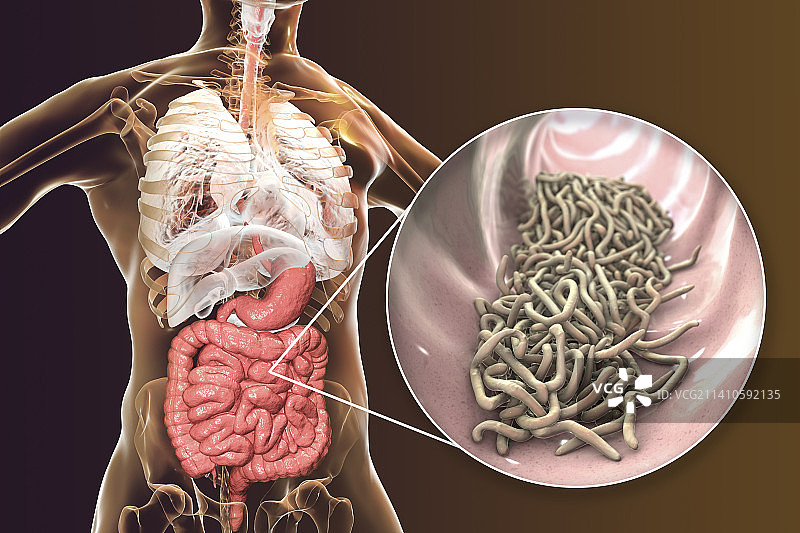 人肠道内的蛔虫，图示图片素材