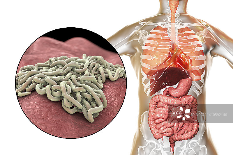 人肠道内的蛔虫，图示图片素材