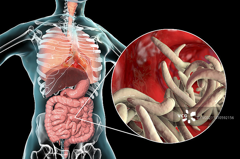 人肠道内的蛔虫，图示图片素材