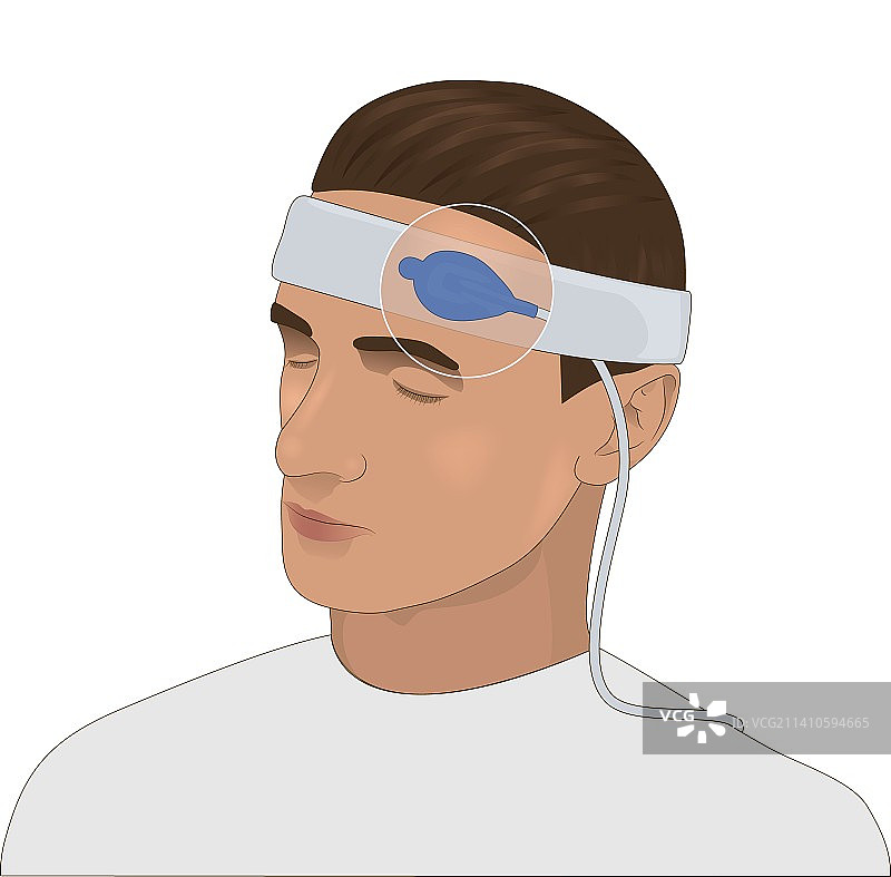 额头脉搏血氧仪，图示图片素材