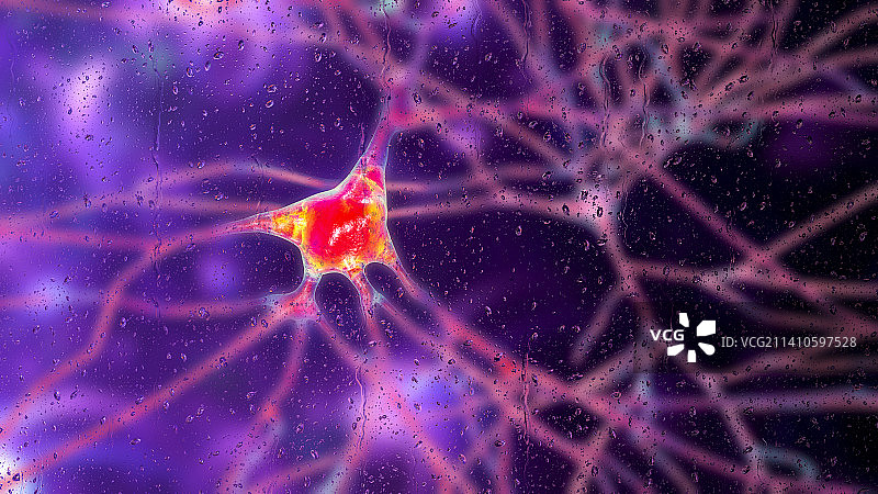 痴呆症中的神经元概念图图片素材