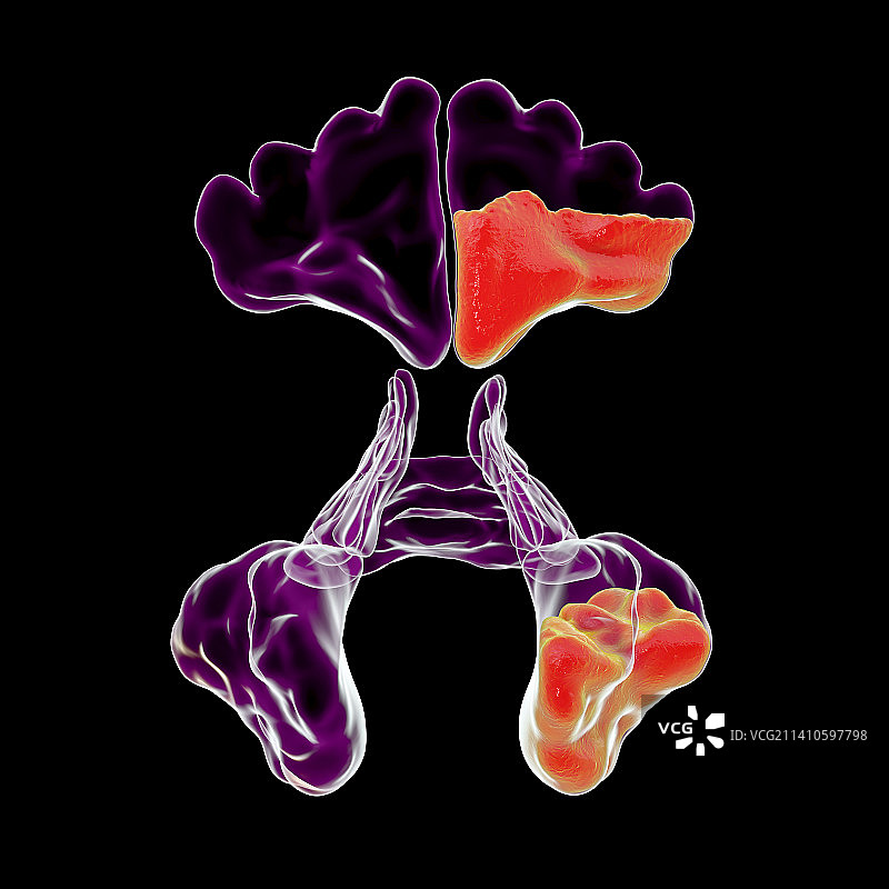 鼻窦炎插图图片素材