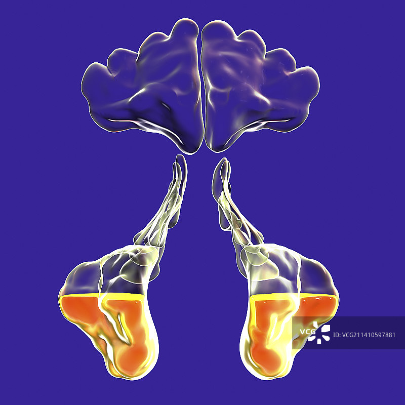 鼻窦炎插图图片素材