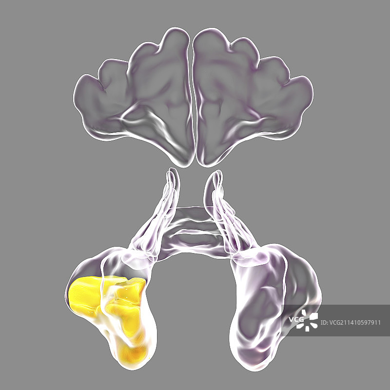 鼻窦炎插图图片素材